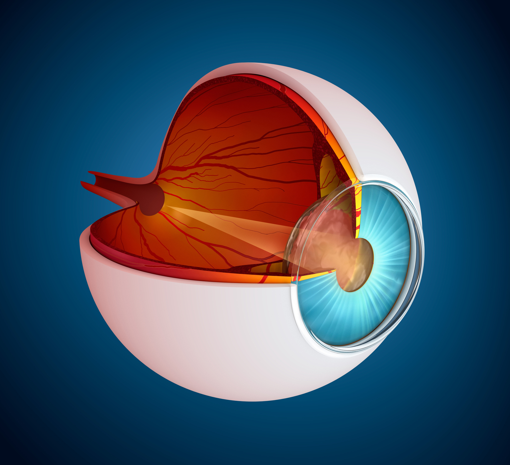 Choroidal Neovascularization - A Pipeline Analysis Report